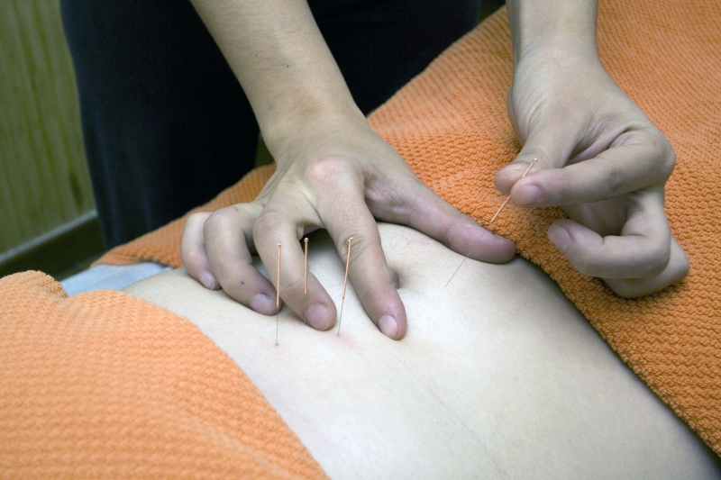 osteopathe-ST CYR SUR MER-min_acupuncture-4175625